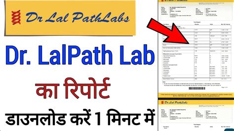 dr lal pathlabs report download online|lpl reports download.